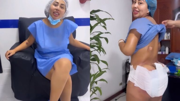 Naya Fácil mostró primeras horas de recuperación tras nueva cirugía estética