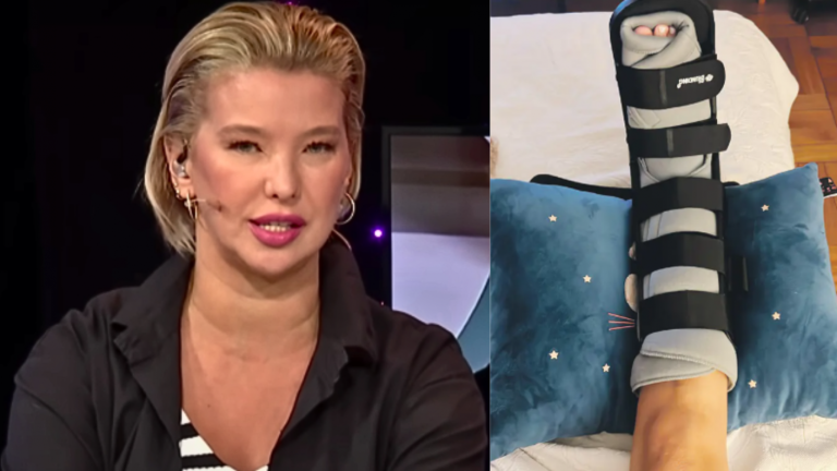 Claudia Schmidt sufrió aparatoso accidente doméstico por el que terminó con licencia: 