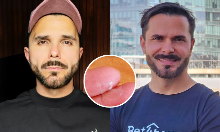 Álvaro Ballero reveló complejo momento por rotura de lente: 