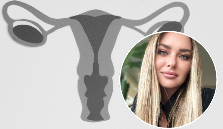 ¿Cuáles son los síntomas del cáncer de útero? La enfermedad que afecta a Daniela Nicolás