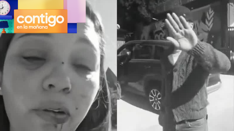 Mujer denuncia a abogado por brutal golpiza tras accidente vial: “Su mujer me chocó…”