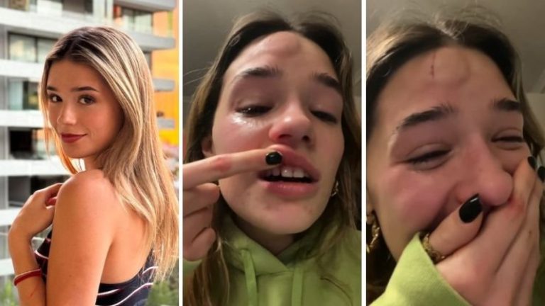 Alessia Traverso sufrió brutal caída en casa y grabó momento exacto: “No lo intenten”