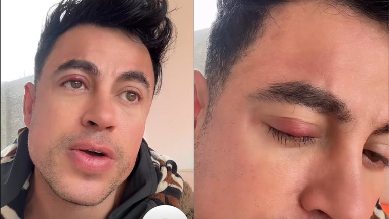 Bruno Zaretti preocupó al contar que se someterá a delicada operación: “No me va a ganar”