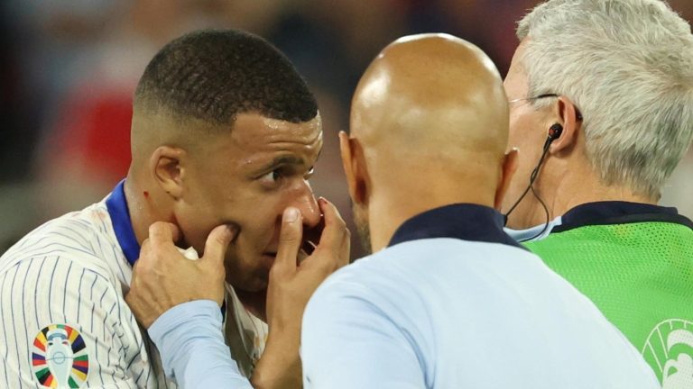 Impactante: El brutal choque de Kylian Mbappé que le provocó fractura de nariz en plena Eurocopa
