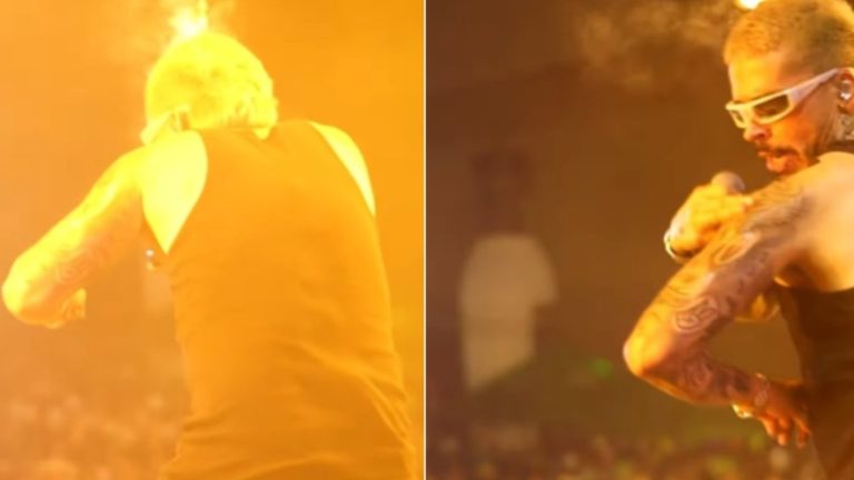 Impacto en Colombia: Reconocido artista fue alcanzado por máquina lanzallamas en pleno concierto