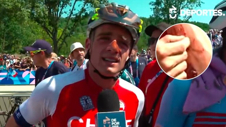 La impactante herida de Martín Vidaurre tras competir en los Juegos Olímpicos 2024: “Me costó”