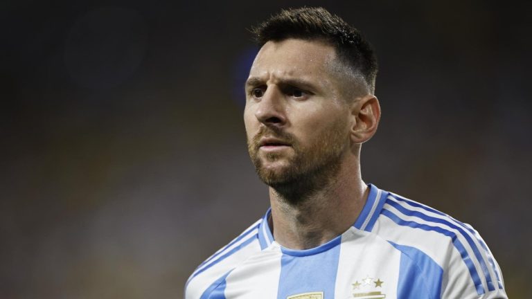 Imagen sensible: Así quedó el tobillo de Lionel Messi en la final ante Colombia