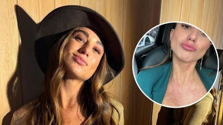 Tita Ureta actualizó su estado de salud tras preocupantes fotos en redes: “Puro aprendizaje”