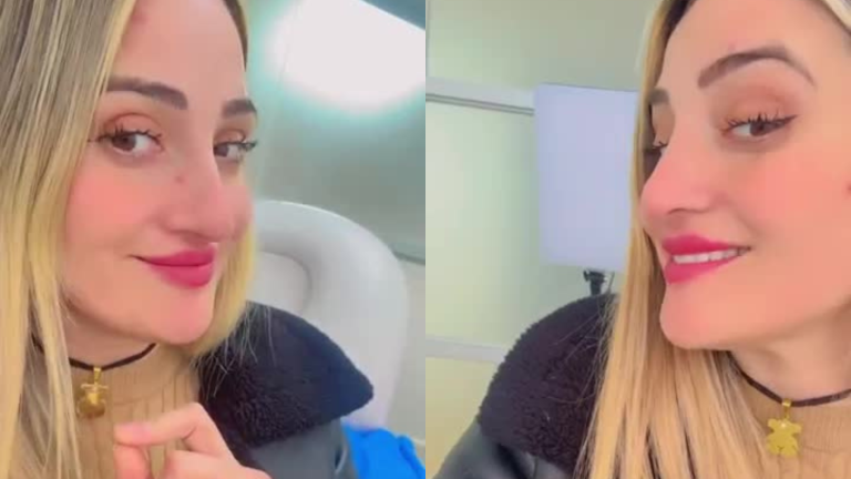 Linda Marcovich reveló procedimiento estético tras salir de Gran Hermano: “Misión secreta”