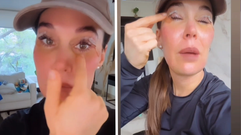 Vale Roth mostró los cambios tras “invasiva” cirugía estética: “No me va a...”