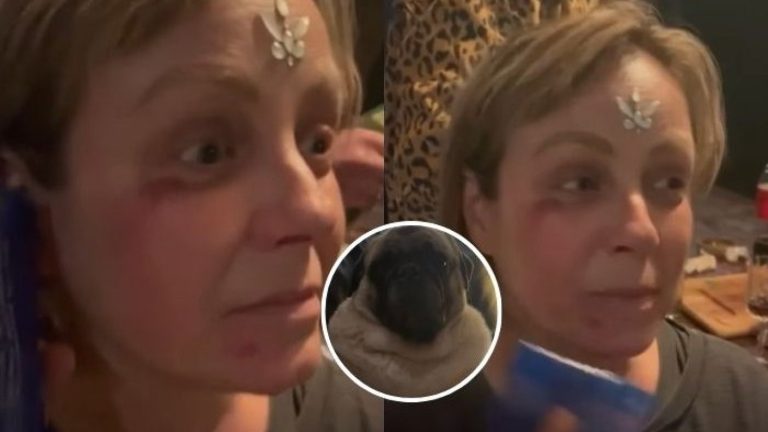 El doloroso accidente de Claudia Conserva en Fiestas Patrias: “Por salvarle la vida”