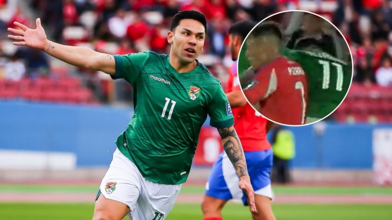 “Mal intencionado”: Hinchas van con todo a Instagram de jugador que lesionó a Vicente Pizarro