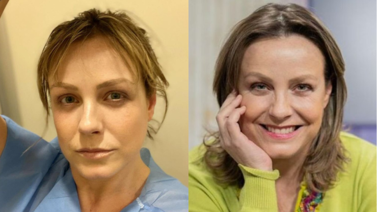 “Aterrador realizarlo”: Claudia Conserva fue a su primera mamografía tras padecer de cáncer