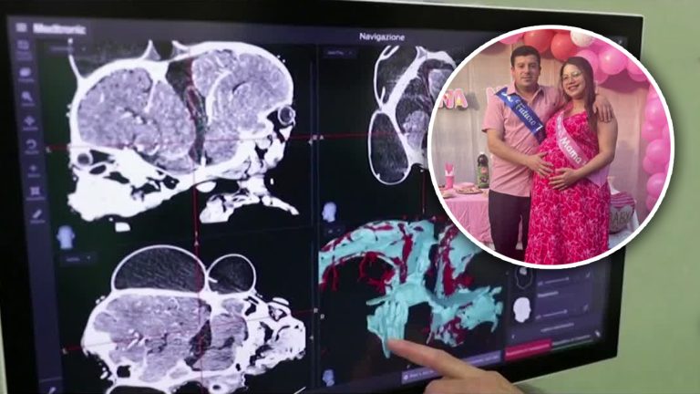 Madre espera trillizas y dos son siamesas: Familia pide ayuda para costear riesgosa operación