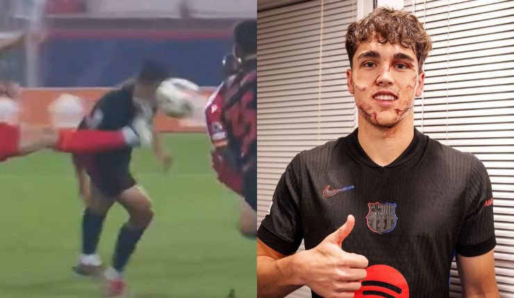 Con puntos de sutura: Así quedó la cara de Pau Cubarsí tras recibir brutal patada en la Champions