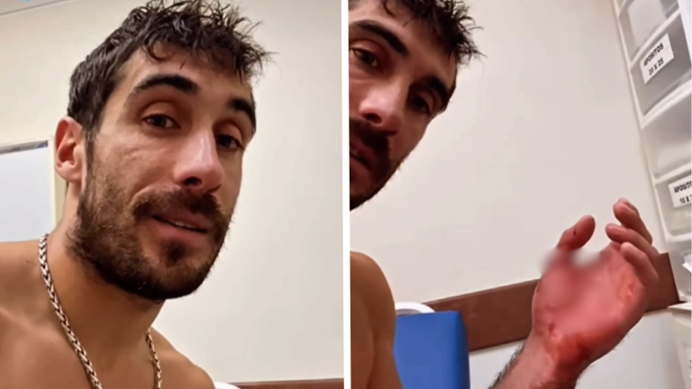 Pedro Astorga llegó a urgencias tras sufrir feo accidente en su kayak: Estará varios días en reposo