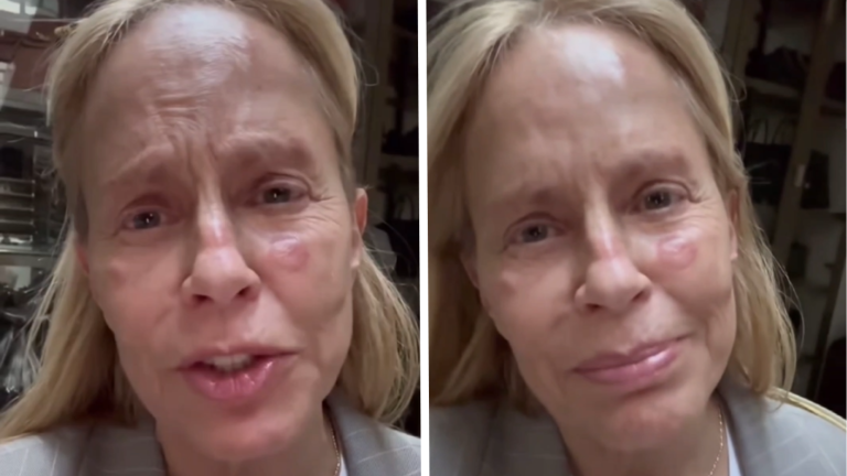 Cecilia Bolocco se bajó de la Teletón por procedimiento médico: “Estaba muy asustada”