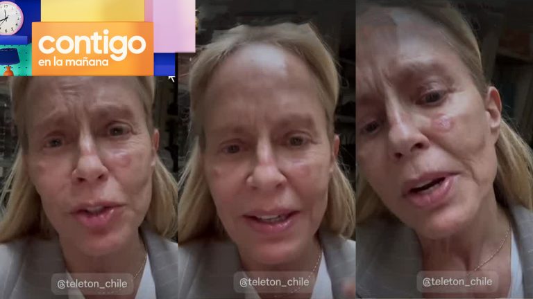 “Me tengo que cuidar”: Cecilia Bolocco sufrió inconveniente médico y no será parte de la Teletón