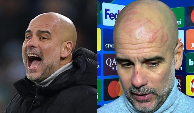 Guardiola aclara sus heridas en la cabeza tras empate del Manchester City en Champions: “Me pillaron”
