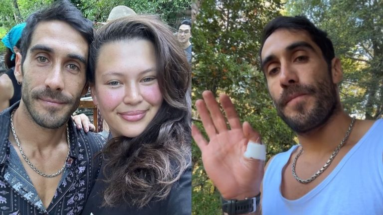 Michelle Carvalho dejó coqueto mensaje a Pedro Astorga tras accidente: “Llegaré para cuidarte”