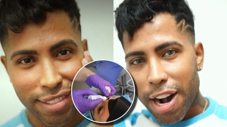 Expertos advierten riesgos de cirugía para cambiarse el color de ojos