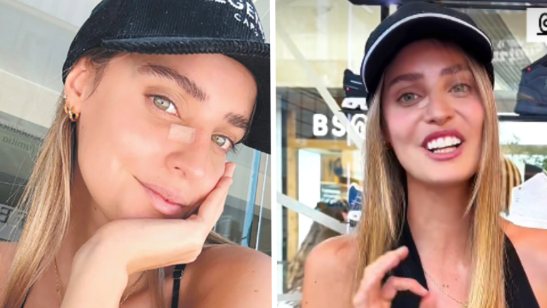 Trinidad de la Noi se sometió a cirugía por un cáncer de piel: “Nunca me afligí”