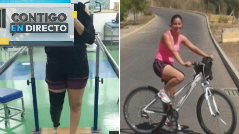 Joven perdió su pierna tras presunta negligencia en cirugía estética: Deberán pagarle $260 millones