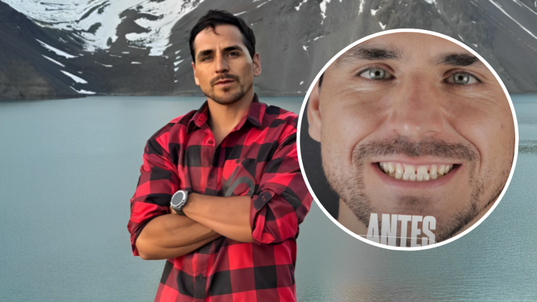 La nueva sonrisa de Pangal Andrade: ¿En qué consiste el procedimiento estético que se realizó?