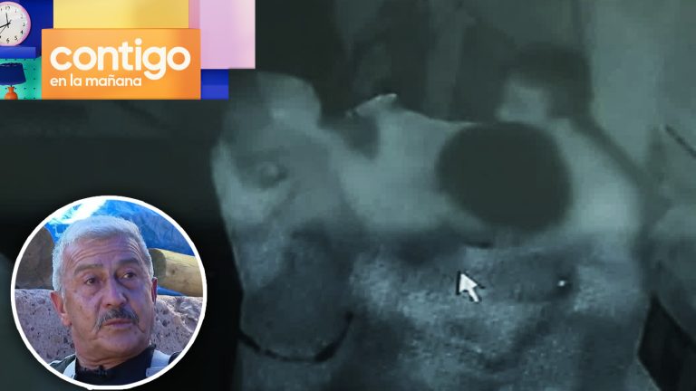 Conserje sufrió violenta golpiza por descontrolado residente en Reñaca: “Quiero justicia”