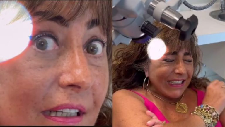 Helhue Sukni impactó tras retirarse los puntos de su operación: Sorprendió con el resultado