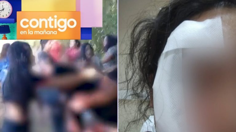 Graban a hombre cortando la cara de menor de edad con una botella para impedir ingreso a río en Purén