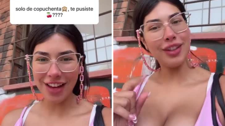 Eskarcita contó la verdad tras rumores de cirugía plástica: “Les muestro toda mi vida…”