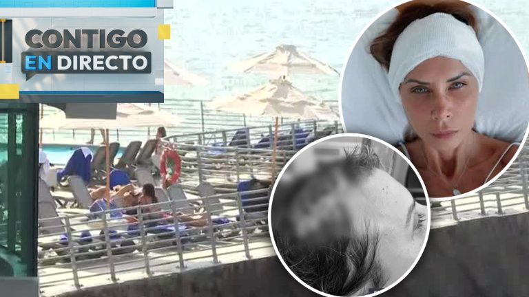 Ex modelo sufrió violento accidente en conocido hotel y denunció falta de ayuda: “Caminé sangrando”