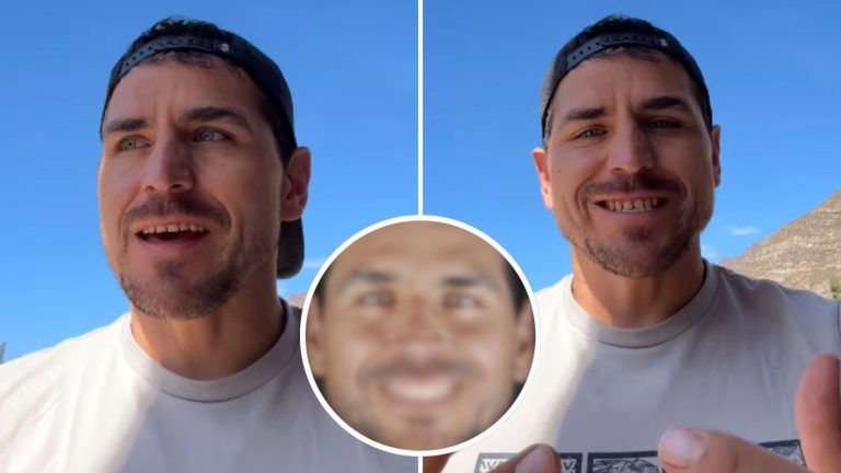 “Tremendo cambio”: Pangal reveló el resultado final de su sonrisa e impactó a sus seguidores