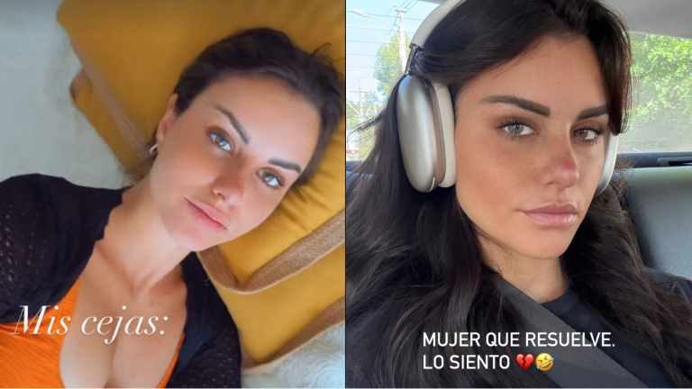 “Eran un tema”: Emilia Dides se realizó drástico procedimiento estético para el Miss Universo