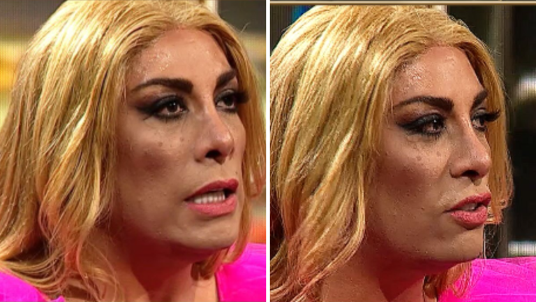 Botota Fox reveló complejo momento que vivió tras sobredosis: “Es tocar fondo”