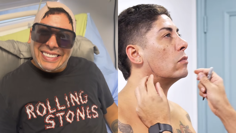 Botota Fox reveló nuevas imágenes sobre la cirugía estética a la que se sometió