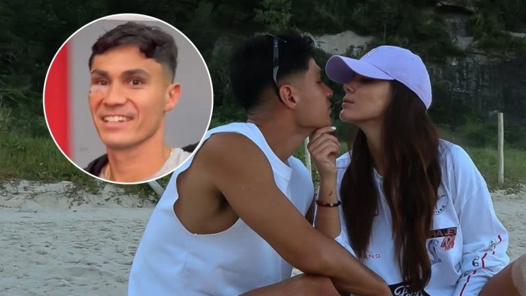 “Mi Rocky Balboa”: Cata Vallejos mostró cómo le quedó la cara a Pablo Galdames tras brutal corte