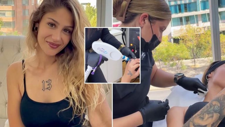 “No me dolió nada”: Estos fueron los dos tatuajes que Trini Neira eliminó con moderno método