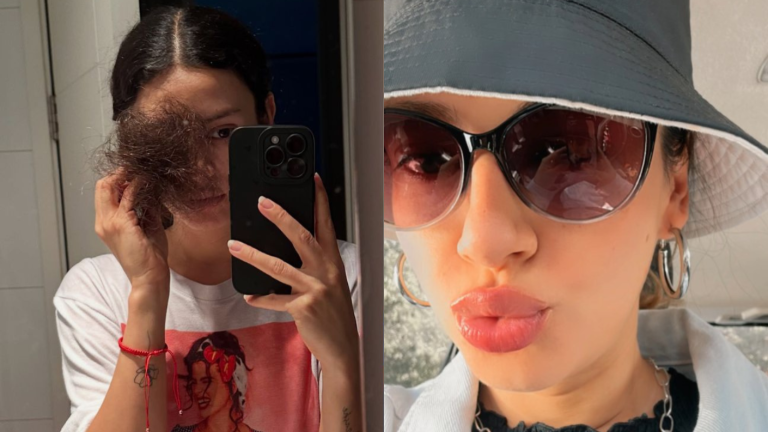 Karla Melo mostró efectos de quimioterapia tras diagnóstico de cáncer: “Sé que volverás a crecer”