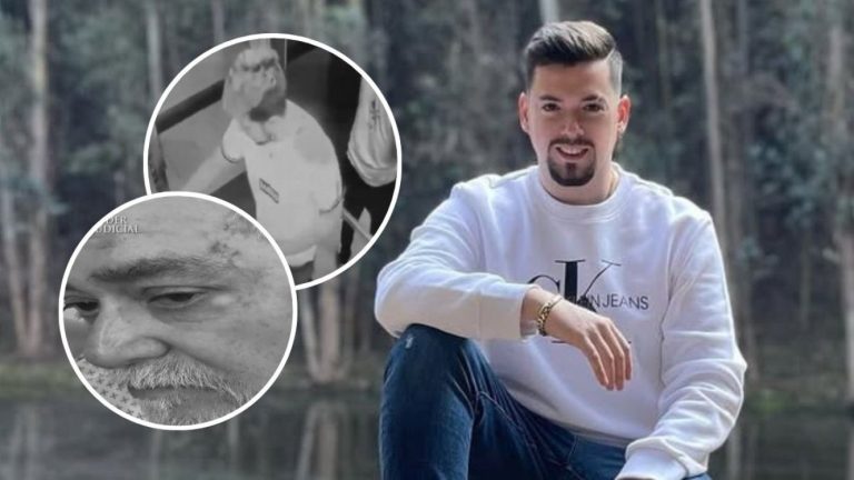 “No podía creer que...”: Nano Calderón entregó su versión sobre violento ataque con cuchillo a su padre