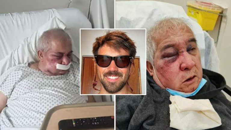 Con fracturas y riesgo de perder el ojo: El complejo estado de salud de conserje de 70 años atacado