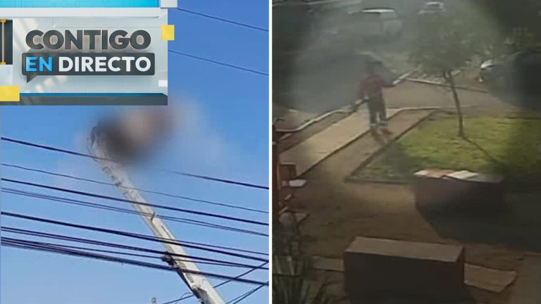 Trabajador perdió su brazo tras electrocutarse al podar árbol: Familia acusa negligencia de empresa