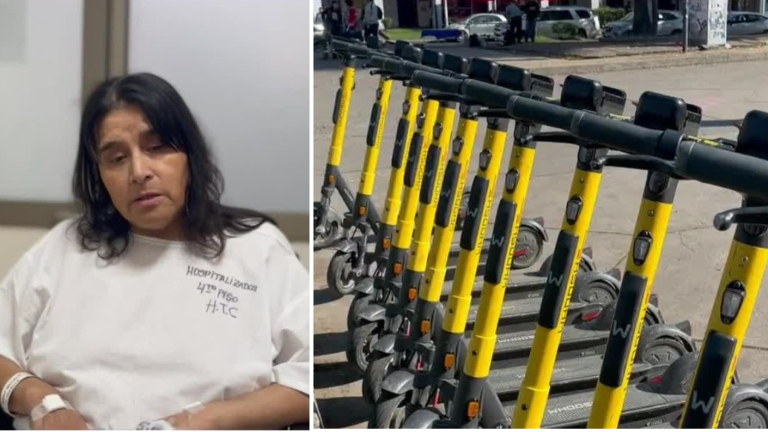 Habla víctima de atropello de scooter eléctrico: Terminó grave y lleva casi dos meses hospitalizada