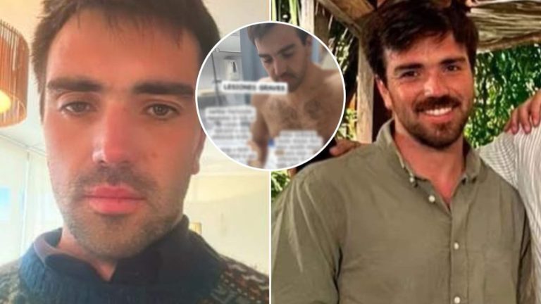 “Intentaron matarme”: Acusado de golpear a conserje de 70 años rompe el silencio tras denuncia