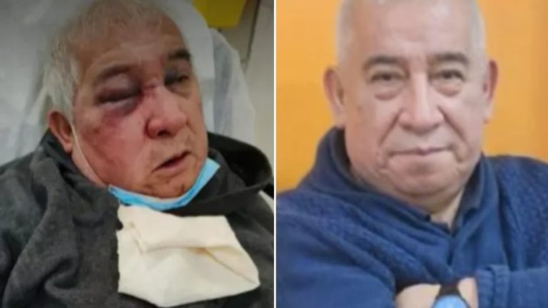 Más grave de lo que pensaban: Actualizan estado de salud de conserje agredido en Vitacura