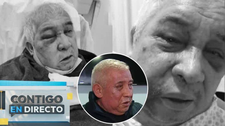 “Ni se han acordado de mí”: Conserje agredido en Vitacura lamentó falta de ayuda de empresa que lo contrató