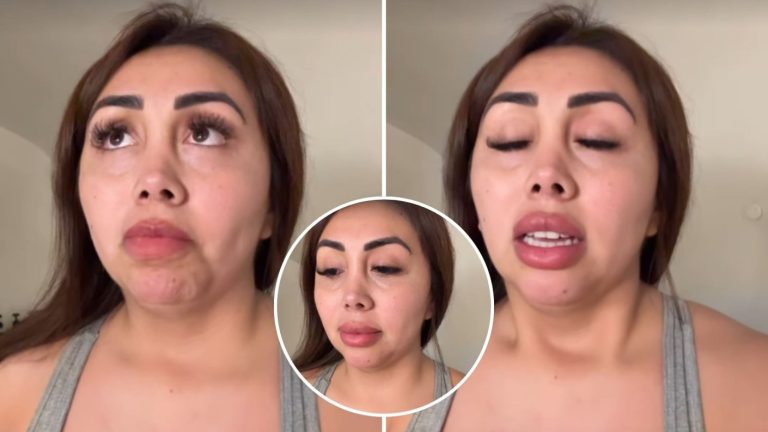 “A la gente infeliz...” Naya Fácil arremetió contra quienes critican su afección en la piel