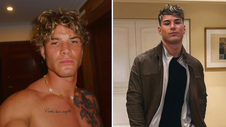 Rabdomiólisis: Raimundo Cerda reveló cuál es el diagnóstico que lo mantiene internado