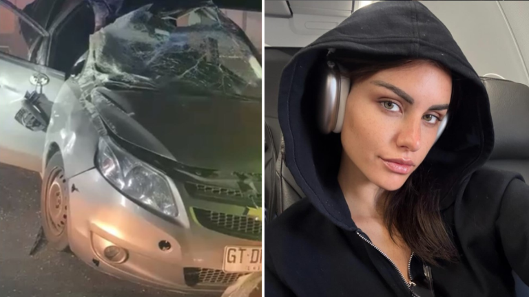 “Así está hoy”: Emilia Dides mostró heridas de grave accidente automovilístico que sufrió hace 2 años